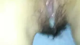 تصحيح جنسي شديد