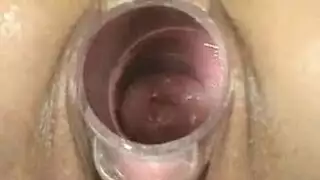 ضرب و مص الصدر ب قوه